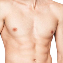 Half Front Laser Hair Reduction