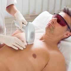 Half front Laser Hair Reduction