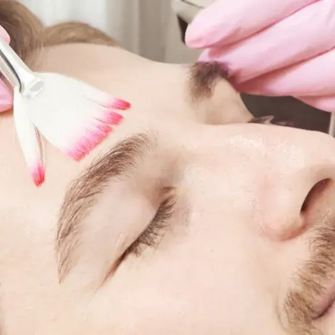 Lactic Peel