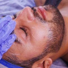 Salicylic Peel